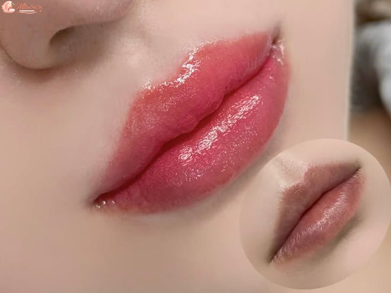 Ưu điểm Mitu Skin phun xăm môi
